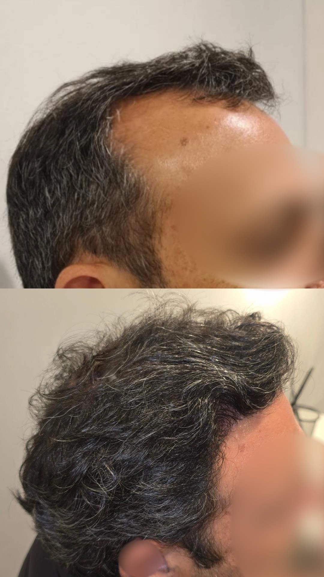 Imagem clínica comparativa de cabelo